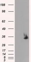 WB analysis of HEK293T cells transfected with Serine racemase plasmid (Right) or empty vector (Left) for 48 hrs using GTX83568 Serine racemase antibody [7E8]. Loading : 5 ug per lane