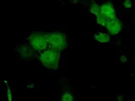 ICC/IF analysis of COS7 cells transiently transfected with Serine racemase plasmid using GTX83568 Serine racemase antibody [7E8].