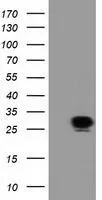 WB analysis of wild type and SPR knock out HeLa cell lysate(10ug per lane) using GTX83572 SPR antibody [1F4]. Dilution : 1:500