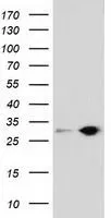WB analysis of HEK293T cells transfected with SPR plasmid (Right) or empty vector (Left) for 48 hrs using GTX83574 SPR antibody [3A9]. Loading : 5 ug per lane