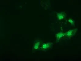 ICC/IF analysis of COS7 cells transiently transfected with SPR plasmid using GTX83574 SPR antibody [3A9].