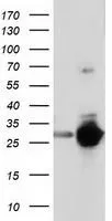 WB analysis of HEK293T cells transfected with SPR plasmid (Right) or empty vector (Left) for 48 hrs using GTX83575 SPR antibody [3D6]. Loading : 5 ug per lane