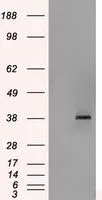 WB analysis of HEK293T cells transfected with Sorbitol Dehydrogenase plasmid (Right) or empty vector (Left) for 48 hrs using GTX83583 Sorbitol Dehydrogenase antibody [2A10]. Loading : 5 ug per lane