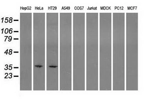 WB analysis of various cell lines using GTX83583 Sorbitol Dehydrogenase antibody [2A10]. Loading : 35 ug per lane