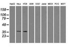 WB analysis of various cell lines using GTX83589 Sorbitol Dehydrogenase antibody [9E7]. Loading : 35 ug per lane