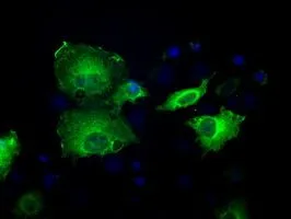 ICC/IF analysis of COS7 cells transiently transfected with Sorbitol Dehydrogenase plasmid using GTX83589 Sorbitol Dehydrogenase antibody [9E7].