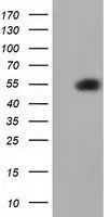 WB analysis of HEK293T cells transfected with SMAD2 plasmid (Right) or empty vector (Left) for 48 hrs using GTX83613 SMAD2 antibody [4G7]. Loading : 5 ug per lane