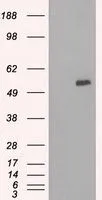 WB analysis of HEK293T cells transfected with SLC7A8 plasmid (Right) or empty vector (Left) for 48 hrs using GTX83620 SLC7A8 antibody [8B12]. Loading : 5 ug per lane