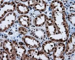 IHC-P analysis of kidney tissue using GTX83645 SIL1 antibody [1F9]. Antigen retrieval : Heat-induced epitope retrieval by 10mM citrate buffer, pH6.0, 100oC for 10min. Dilution : 1:50