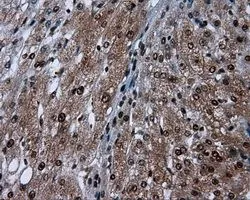 IHC-P analysis of liver tissue using GTX83645 SIL1 antibody [1F9]. Antigen retrieval : Heat-induced epitope retrieval by 10mM citrate buffer, pH6.0, 100oC for 10min. Dilution : 1:50