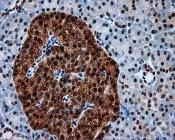 IHC-P analysis of pancreas tissue using GTX83645 SIL1 antibody [1F9]. Antigen retrieval : Heat-induced epitope retrieval by 10mM citrate buffer, pH6.0, 100oC for 10min. Dilution : 1:50