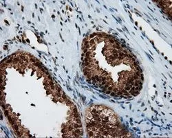 IHC-P analysis of prostate tissue using GTX83645 SIL1 antibody [1F9]. Antigen retrieval : Heat-induced epitope retrieval by 10mM citrate buffer, pH6.0, 100oC for 10min. Dilution : 1:50