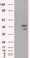 WB analysis of HEK293T cells transfected with SHC1 plasmid (Right) or empty vector (Left) for 48 hrs using GTX83655 SHC1 antibody [1D3]. Loading : 5 ug per lane