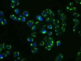 ICC/IF analysis of HT29 cells using GTX83655 SHC1 antibody [1D3].