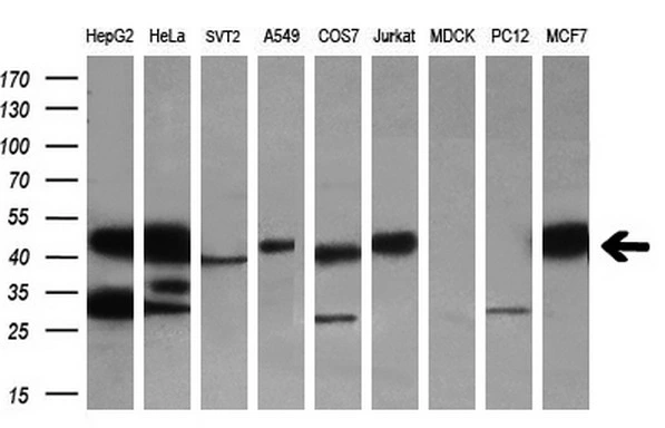 WB analysis of various cell lines using GTX83658 SH3GL1 antibody [3F8]. Loading : 35 ug per lane Dilution : 1:200
