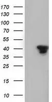 WB analysis of HEK293T cells transfected with SH3GL1 plasmid (Right) or empty vector (Left) for 48 hrs using GTX83658 SH3GL1 antibody [3F8]. Loading : 5 ug per lane