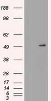 WB analysis of various cell lines using GTX83665 alpha 1 Antitrypsin antibody [15H10]. Loading : 35 ug per lane