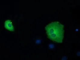 ICC/IF analysis of COS7 cells transiently transfected with SDR9C7 plasmid using GTX83669 SDR9C7 antibody [7E11].