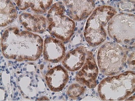 IHC-P analysis of human kidney tissue using GTX83671 SDR9C7 antibody [4B5]. Antigen retrieval : Heat-induced epitope retrieval by 10mM citrate buffer, pH6.0, 100oC for 10min.