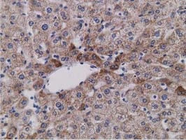IHC-P analysis of human liver tissue using GTX83671 SDR9C7 antibody [4B5]. Antigen retrieval : Heat-induced epitope retrieval by 10mM citrate buffer, pH6.0, 100oC for 10min.