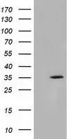 WB analysis of HEK293T cells transfected with SDR9C7 plasmid (Right) or empty vector (Left) for 48 hrs using GTX83671 SDR9C7 antibody [4B5]. Loading : 5 ug per lane