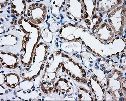 IHC-P analysis of human kidney tissue using GTX83679 SATB1 antibody [11E8]. Antigen retrieval : Heat-induced epitope retrieval by 10mM citrate buffer, pH6.0, 100oC for 10min.