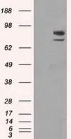 WB analysis of HEK293T cells transfected with SATB1 plasmid (Right) or empty vector (Left) for 48 hrs using GTX83679 SATB1 antibody [11E8]. Loading : 5 ug per lane