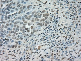 ICC/IF analysis of COS7 cells transiently transfected with SATB1 plasmid using GTX83682 SATB1 antibody [13D6].