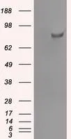 WB analysis of HEK293T cells transfected with SATB1 plasmid (Right) or empty vector (Left) for 48 hrs using GTX83682 SATB1 antibody [13D6]. Loading : 5 ug per lane
