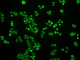 ICC/IF analysis of HT29 cells using GTX83684 SATB1 antibody [10G2].