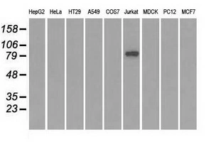 WB analysis of various cell lines using GTX83685 SATB1 antibody [6C6]. Loading : 35 ug per lane