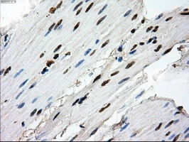 IHC-P analysis of human bladder tissue using GTX83688 RPA32 antibody [8B3]. Antigen retrieval : Heat-induced epitope retrieval by 10mM citrate buffer, pH6.0, 100oC for 10min.