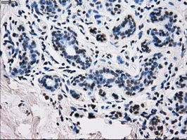 IHC-P analysis of human breast tissue using GTX83688 RPA32 antibody [8B3]. Antigen retrieval : Heat-induced epitope retrieval by 10mM citrate buffer, pH6.0, 100oC for 10min.