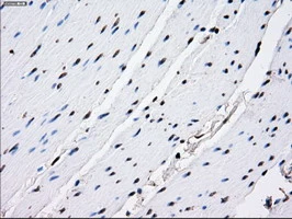IHC-P analysis of human colon tissue using GTX83688 RPA32 antibody [8B3]. Antigen retrieval : Heat-induced epitope retrieval by 10mM citrate buffer, pH6.0, 100oC for 10min.