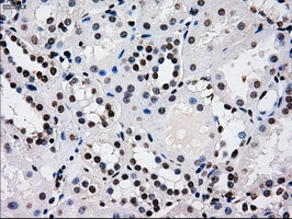IHC-P analysis of human kidney tissue using GTX83688 RPA32 antibody [8B3]. Antigen retrieval : Heat-induced epitope retrieval by 10mM citrate buffer, pH6.0, 100oC for 10min.