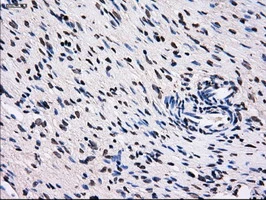 IHC-P analysis of human ovary tissue using GTX83688 RPA32 antibody [8B3]. Antigen retrieval : Heat-induced epitope retrieval by 10mM citrate buffer, pH6.0, 100oC for 10min.