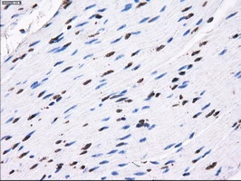 IHC-P analysis of human colon tissue using GTX83695 RPA32 antibody [7C12]. Antigen retrieval : Heat-induced epitope retrieval by 10mM citrate buffer, pH6.0, 100oC for 10min.