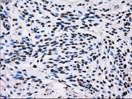 IHC-P analysis of human endometrium tissue using GTX83695 RPA32 antibody [7C12]. Antigen retrieval : Heat-induced epitope retrieval by 10mM citrate buffer, pH6.0, 100oC for 10min.