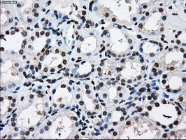 IHC-P analysis of human kidney tissue using GTX83695 RPA32 antibody [7C12]. Antigen retrieval : Heat-induced epitope retrieval by 10mM citrate buffer, pH6.0, 100oC for 10min.