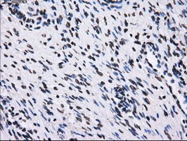 IHC-P analysis of human ovary tissue using GTX83695 RPA32 antibody [7C12]. Antigen retrieval : Heat-induced epitope retrieval by 10mM citrate buffer, pH6.0, 100oC for 10min.