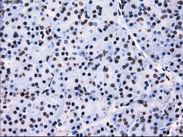 IHC-P analysis of human pancreas tissue using GTX83695 RPA32 antibody [7C12]. Antigen retrieval : Heat-induced epitope retrieval by 10mM citrate buffer, pH6.0, 100oC for 10min.