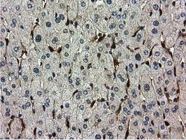 IHC-P analysis of human liver tissue using GTX83696 Ribonuclease Inhibitor antibody [3F11].