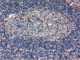 IHC-P analysis of human lymph node tissue using GTX83696 Ribonuclease Inhibitor antibody [3F11].