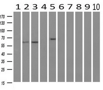 WB analysis of human tissues (Lane 1-Testis ; Lane 2-Omentum ; Lane 3-Uterus ; Lane 4-Breast ; Lane 5-Brain ; Lane 6-Liver ; Lane 7-Ovary ; Lane 8-Thyroid gland ; Lane 9-colon ; Lane 10-spleen) using GTX83714 RIC8A antibody [3G3]. Loading : 10 ug per lane Dilution : 1:200