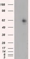 WB analysis of HEK293T cells transfected with RIC8A plasmid (Right) or empty vector (Left) for 48 hrs using GTX83714 RIC8A antibody [3G3]. Loading : 5 ug per lane