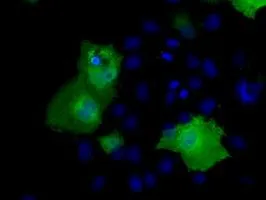 ICC/IF analysis of COS7 cells transiently transfected with RIC8A plasmid using GTX83714 RIC8A antibody [3G3].