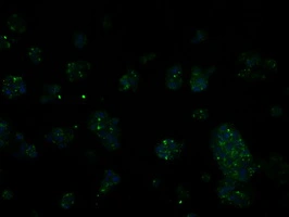 ICC/IF analysis of HepG2 cells using GTX83714 RIC8A antibody [3G3].