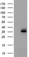 WB analysis of HEK293T cells transfected with RFPL1 plasmid (Right) or empty vector (Left) for 48 hrs using GTX83715 RFPL1 antibody [1D3]. Loading : 5 ug per lane