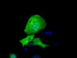 ICC/IF analysis of COS7 cells transiently transfected with RFPL1 plasmid using GTX83715 RFPL1 antibody [1D3].