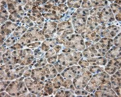 IHC-P analysis of pancreas tissue using GTX83716 RDH11 antibody [1B4]. Antigen retrieval : Heat-induced epitope retrieval by 10mM citrate buffer, pH6.0, 100oC for 10min. Dilution : 1:50